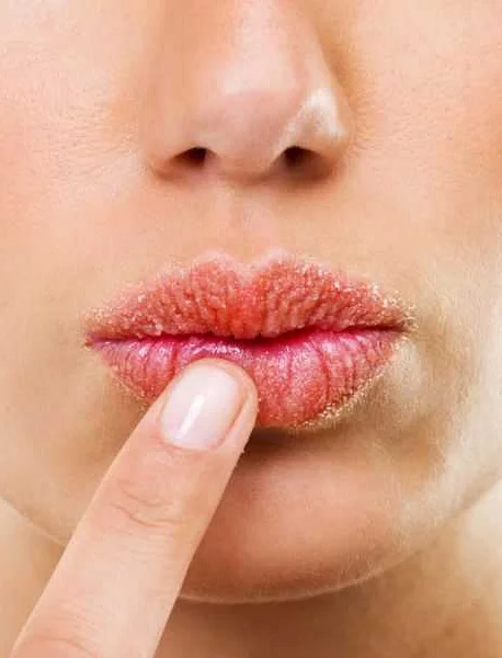 Как правильно увлажнять губы?