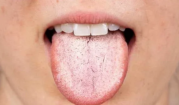 Нарушение pH-баланса во рту
